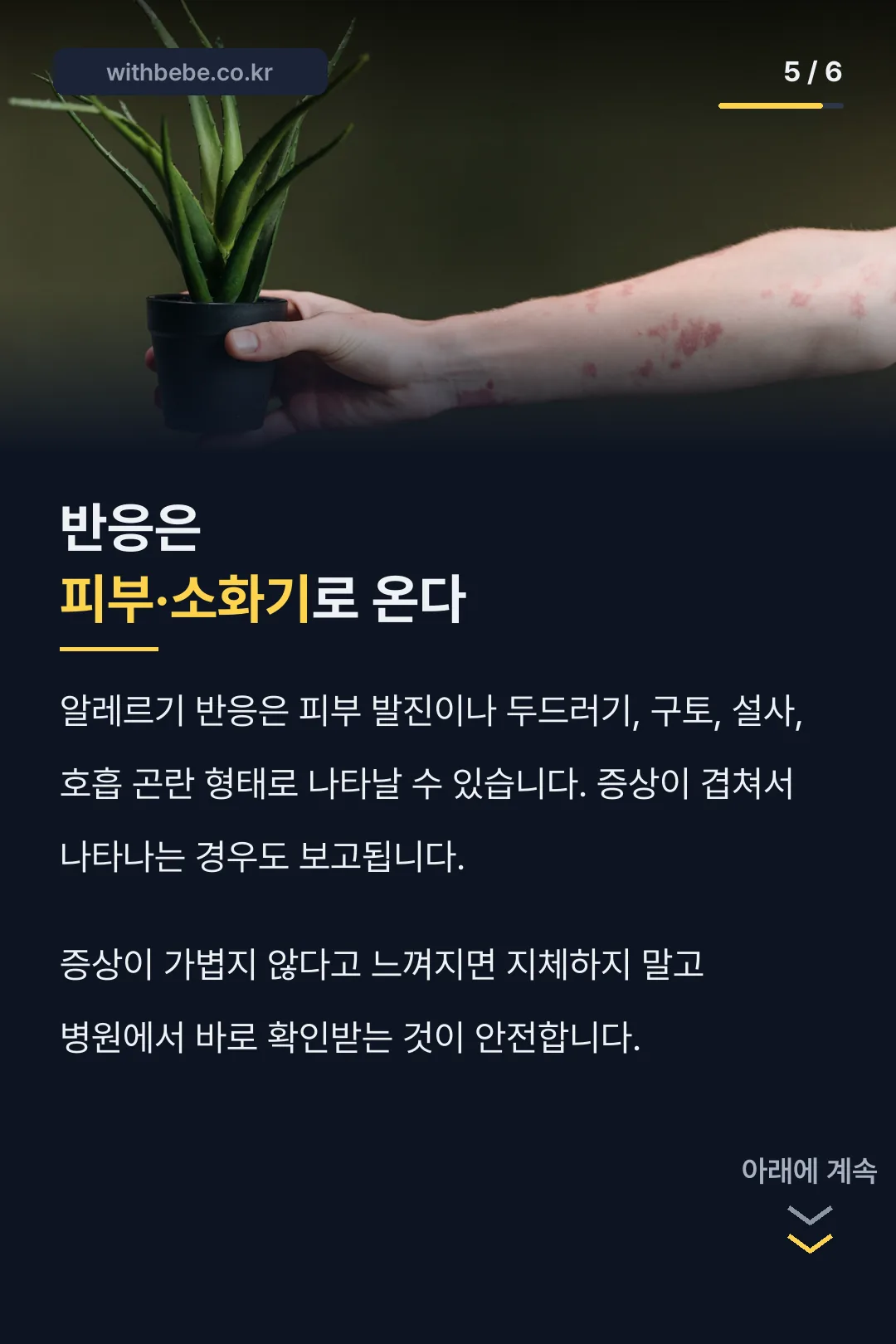 알레르기 반응은 피부·소화기로